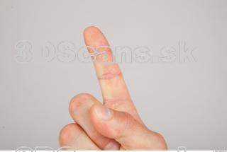 Finger texture of Gene 0002